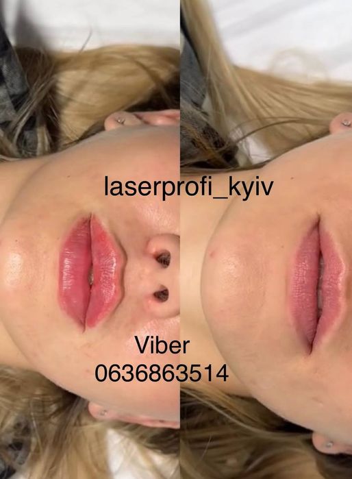 Косметолог Харківський рн.метро Вирлиця