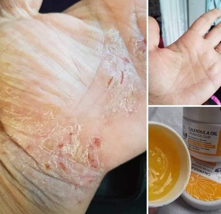 Balsam z nagietka lekarskiego i inne produkty, cudowna seria
