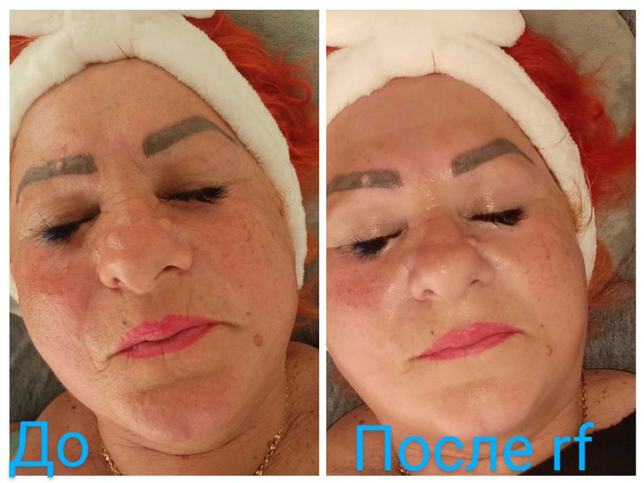 Масаж спини класичний,массаж загальний, масаж ШКЗ, масаж стоп