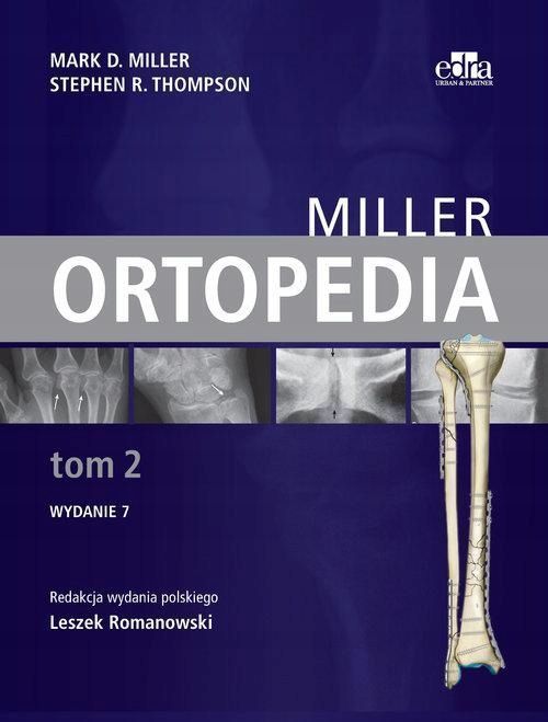 Ortopedia Miller Tom 2, M.d. Miller, S.r. Thompson