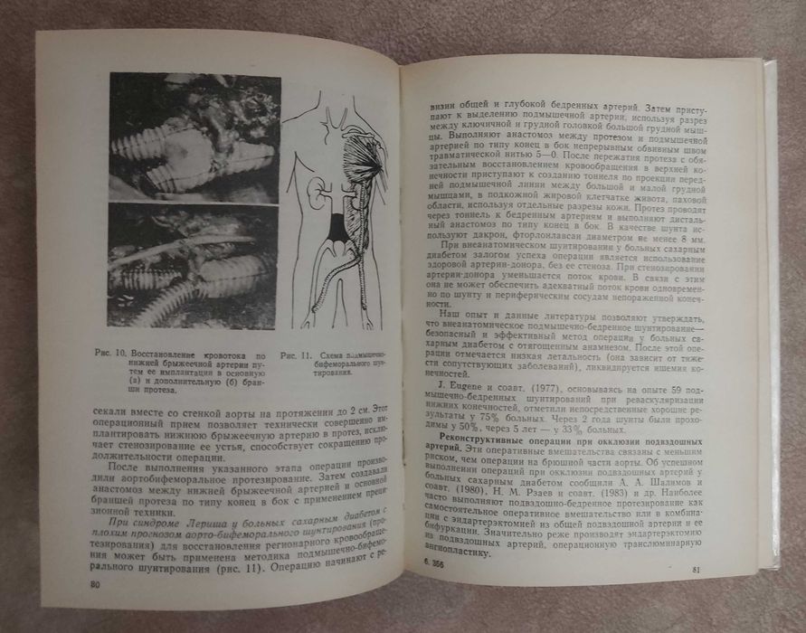 "Хирургия атеросклероза сосудов у больных сахарным диабетом"