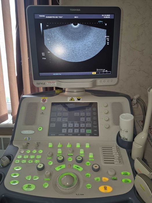 УЗД апарат Toshiba SSA-660A Xario-15 у відмінному стані