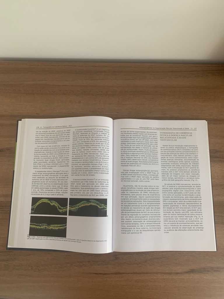Livro "Tomografia de Coerência Óptica" Texto e Atlas 2ª Edição