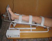устройство для разработки движений в коленном и тазобедренном сустав