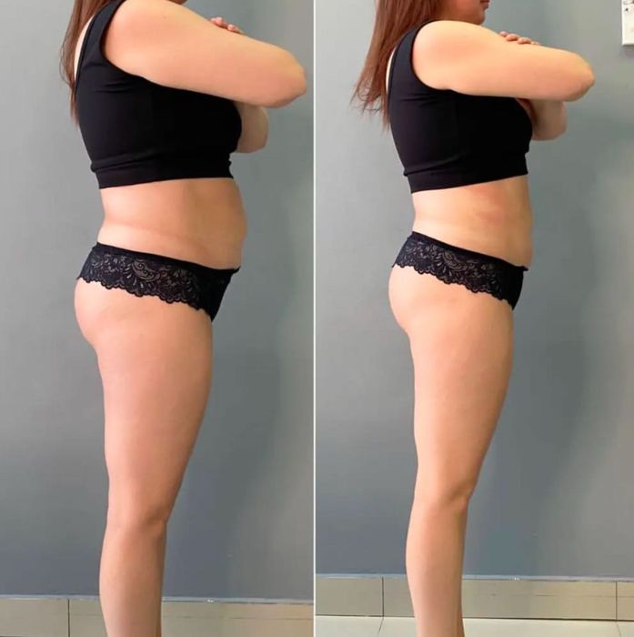 Косметологические услуги Губы/Full face/botox/мезонит/похудени/Ягодицы