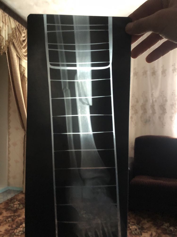 Рентген на дому консультація травматолога