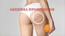 Антіцелюлітний вакуумний масаж м. Осокорки