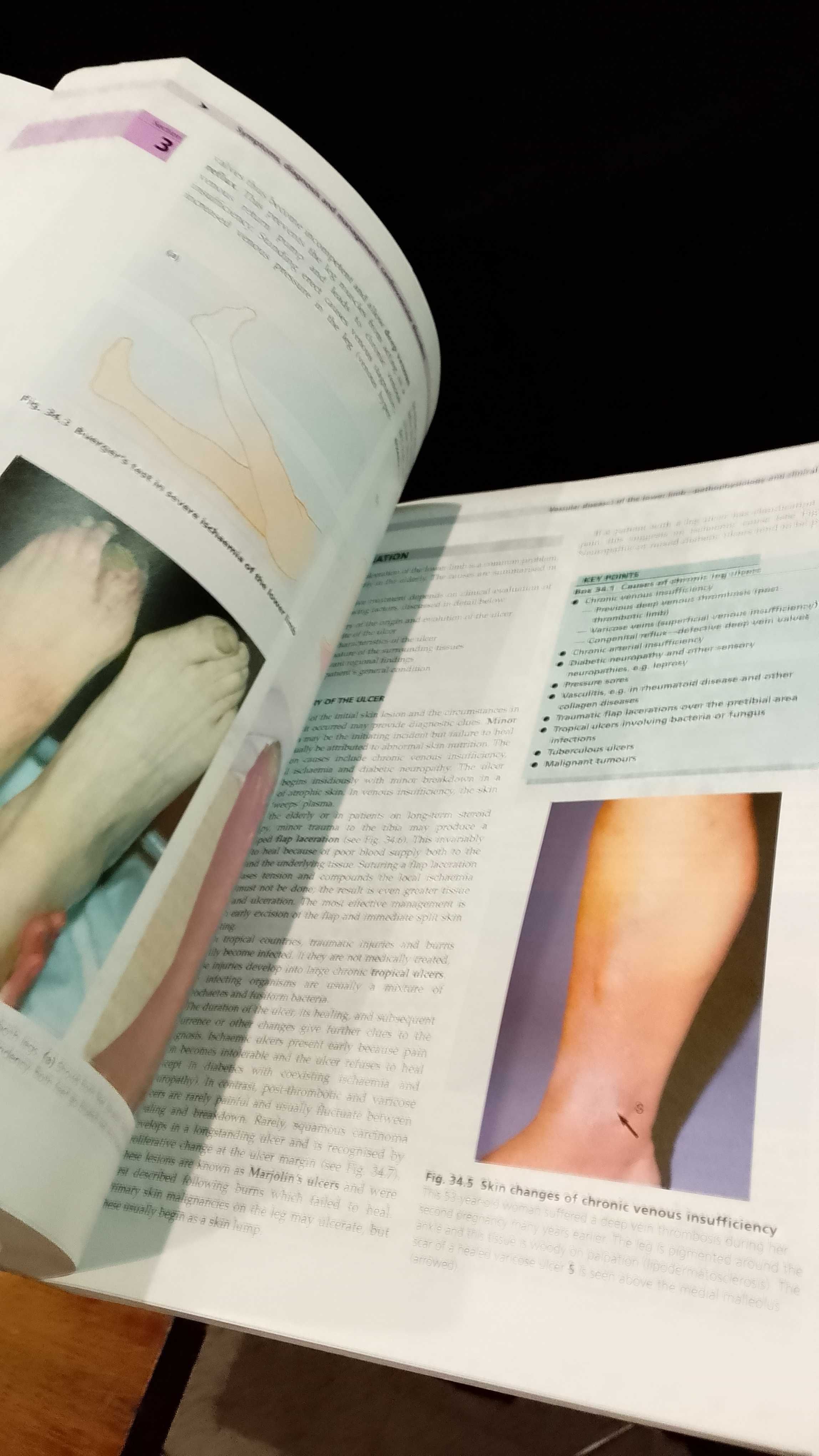 Essential Surgery : Problems, Diagnosis and Management