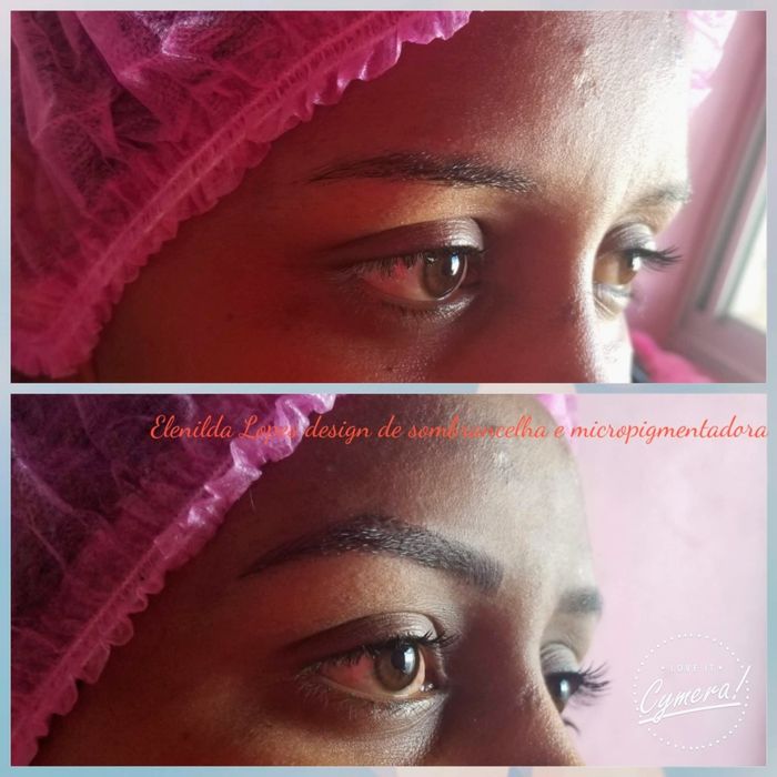 Sobrancelhas correção