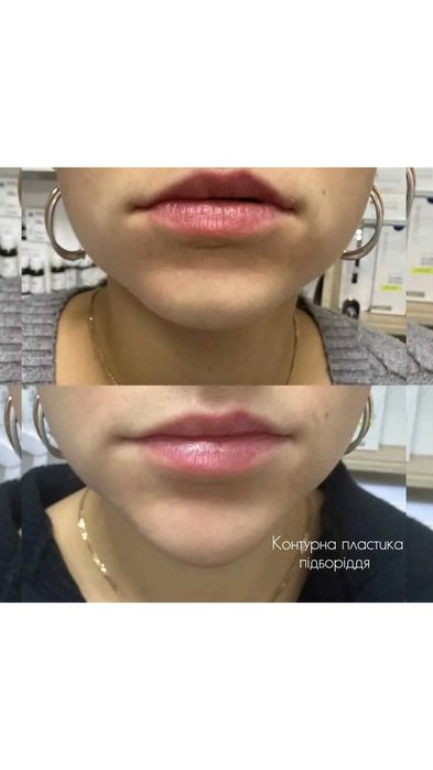 Косметолог, епіляція, корекція фігури