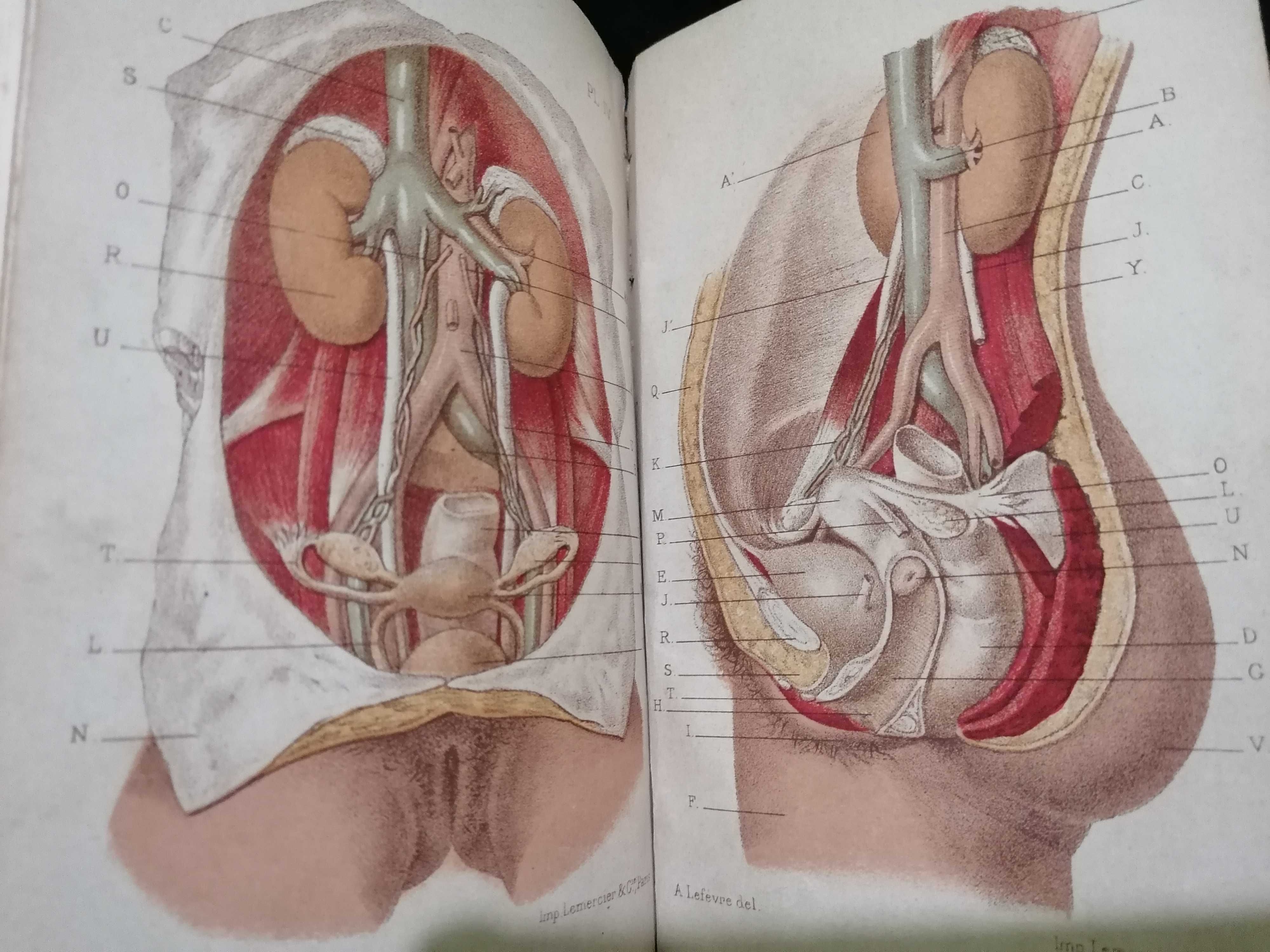 Traité Pratique des Maladies des Voies Urinaires, par Jozan Pére ,1884