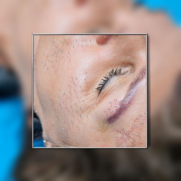 Naturalna Medycyna Estetyczna - akupunkura, masaże twarzy