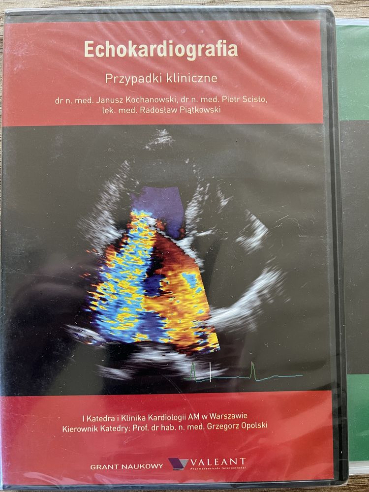 Echokardiografia przypadki kliniczne