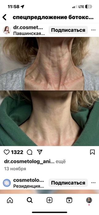 Лікар косметолог. БОТОКС . Ін'єкції краси.