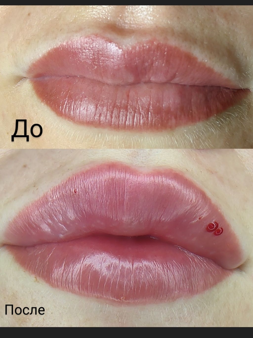 Наращивание ресниц от 650 грн!Перманент,увеличение губ,ботокс