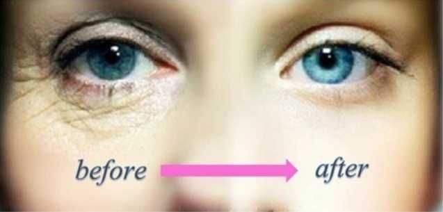 Jeunesse Instantly Ageless LiftingUSA 5szt