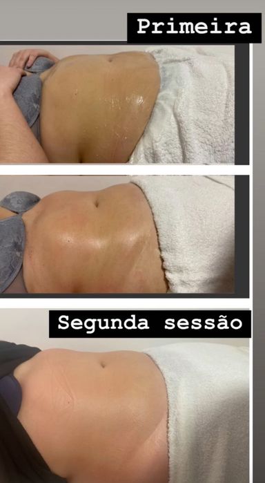Massagem corporal Redutora