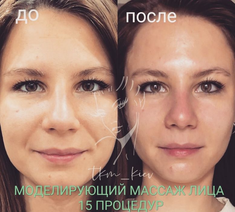 Массаж лица - 600 грн, Косметолог, Оболонь