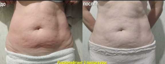 Масаж, косметолог, апаратна косметологiя