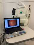 Retinografo kowa nonmyd 7