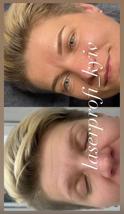 Косметолог Харківський рн.метро Вирлиця