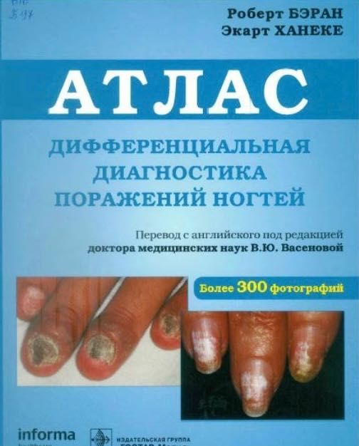 Атлас. Дифференциальная диагностика поражения ногтей Роберт Бэран