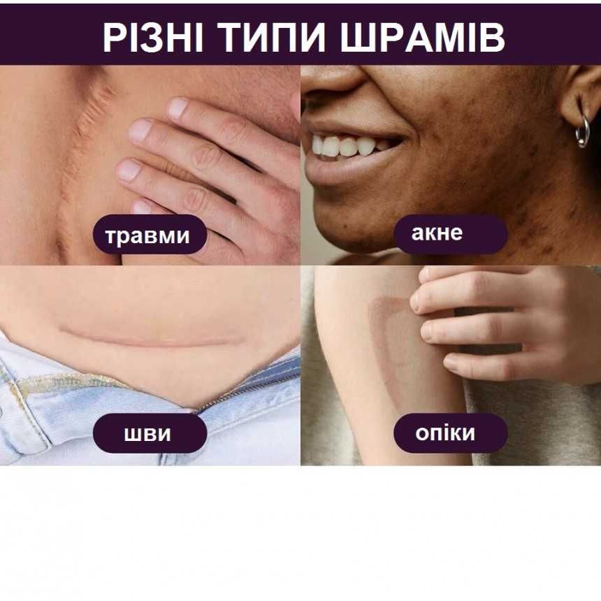Гель від шрамів та рубців Mederma Scar Cream Plus SPF 30 (20 гр)