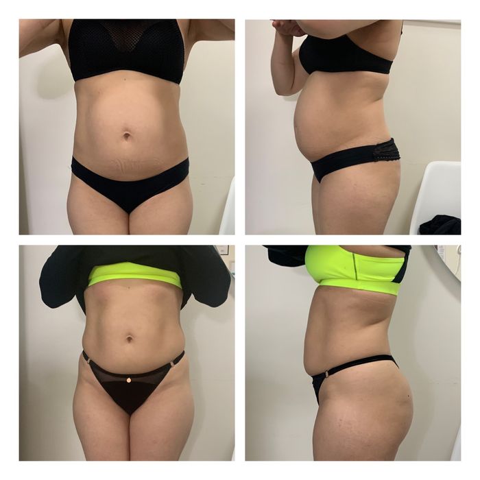 Корекція тіла. Масаж. Обгортування