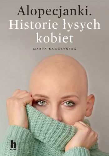 Alopecjanki. Historie łysych kobiet. - Marta Kawczyńska