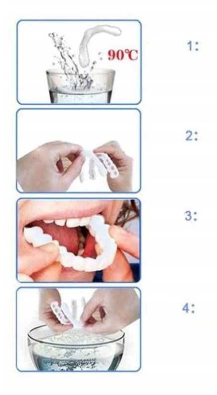 2x zdejmowane licówki do zębów