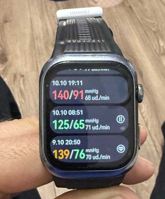 Medyczny Huawei D2 z ciśniemionierzomieniem, EKG.