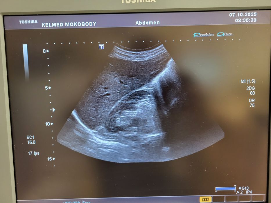 Ultrasonograf aparat USG Toshiba Xario 660a