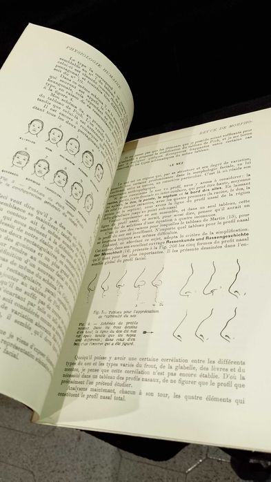 Précisions a l'appréciation de caractères descriptifs en Antropologie