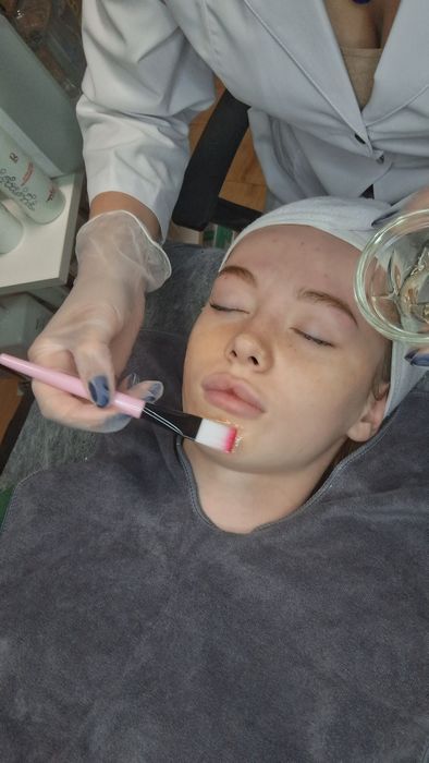 Естетична косметологія. Мікронідлінг