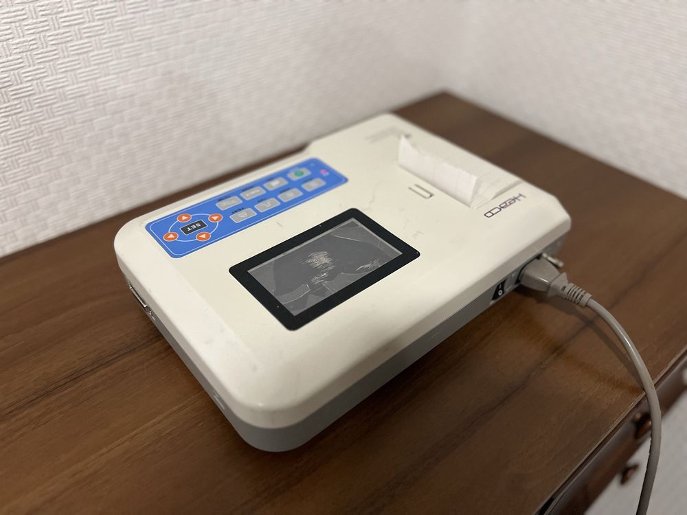 Кардіограф Електрокардіограф ECG300G LCD