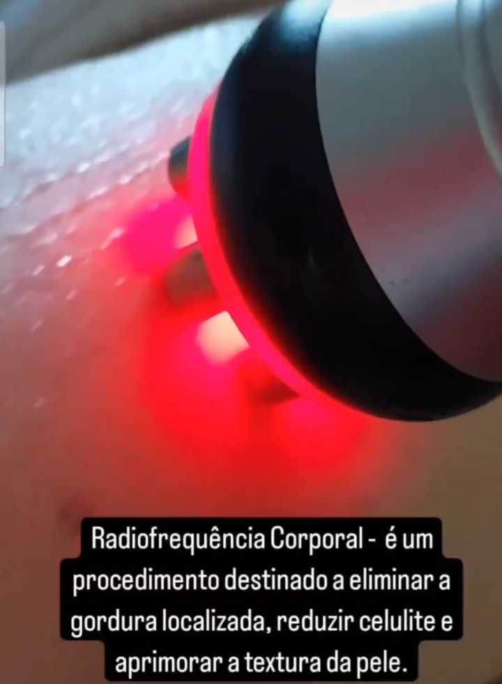 Radiofrequência corpo rosto