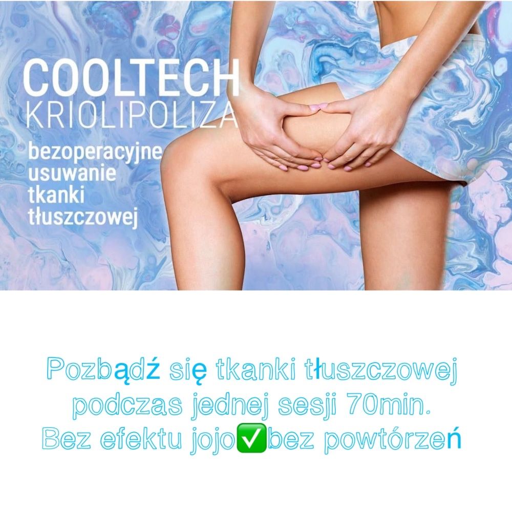 Cool tech ,cooltech medyczna kriolipoliza wynajem +obsluga