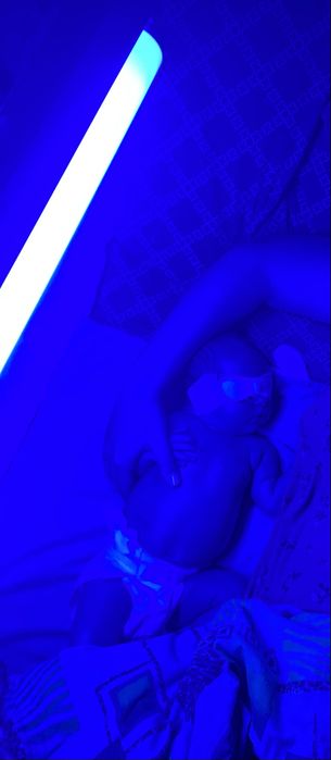 Лампа від жовтяниці/ желтухи/фототерапія