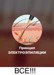 Электроэпиляция космос. Самое усовершенсвованое оборудование в Запорож