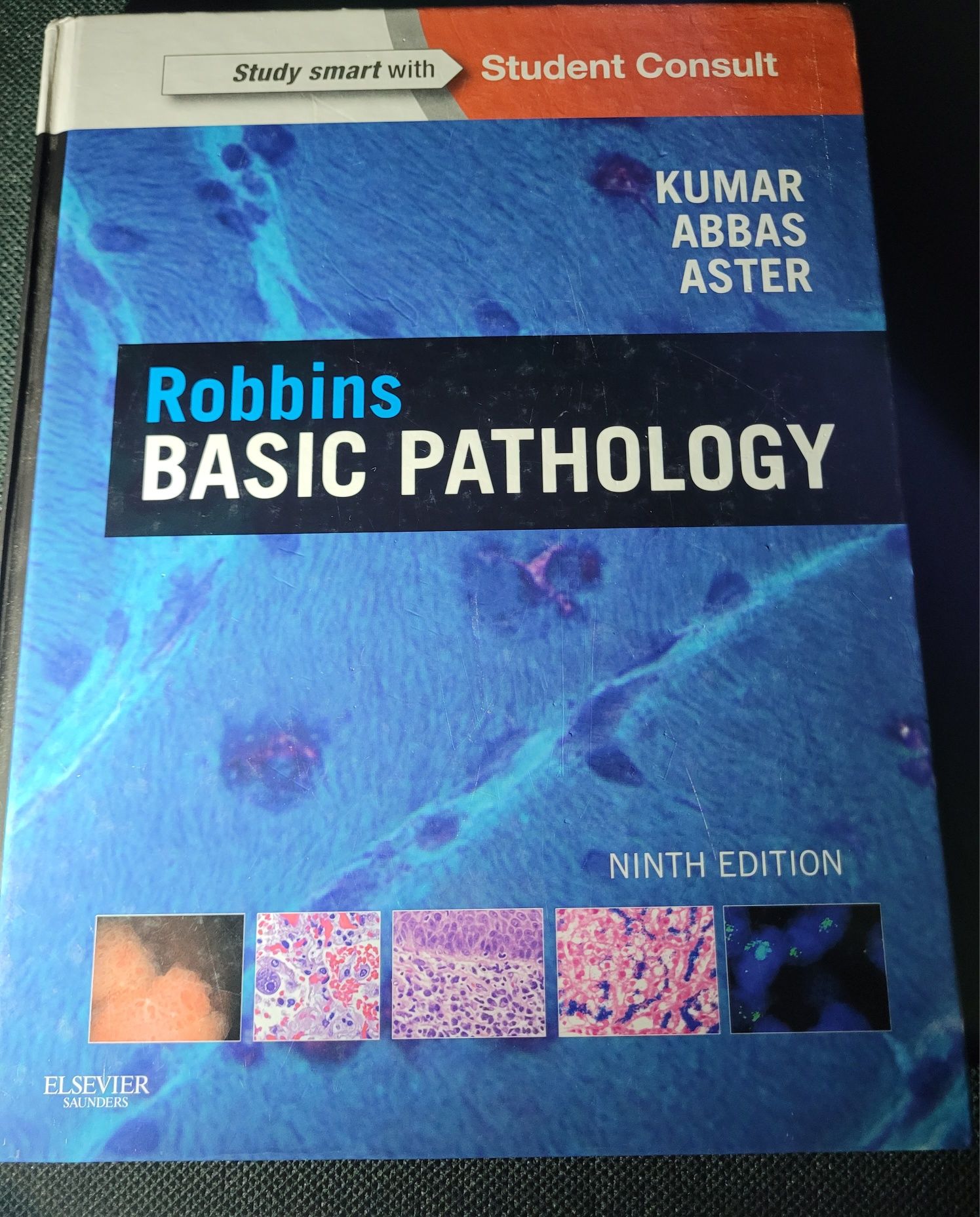 BASIS PATHOLOGY Robbins, Kumar Vinay Abbas Abul K. Aster Jon C.