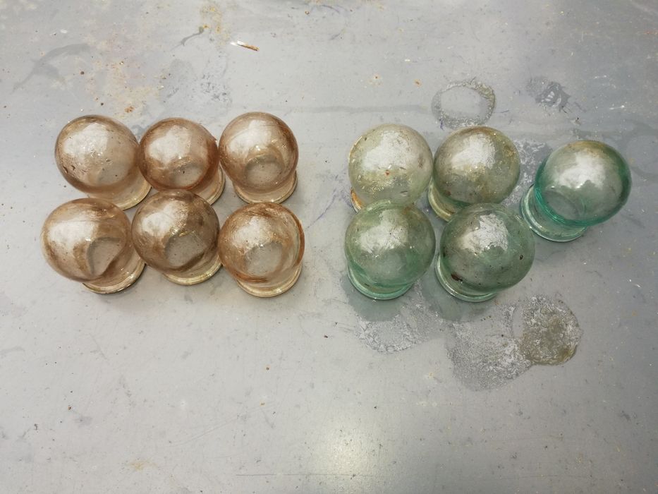 Медицинские банки для массажа и лечения. Вакуумные баночки.