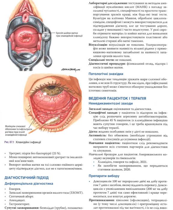 Акушерство та гінекологія за Неттером. 4-те видання. 2025 Гинекология