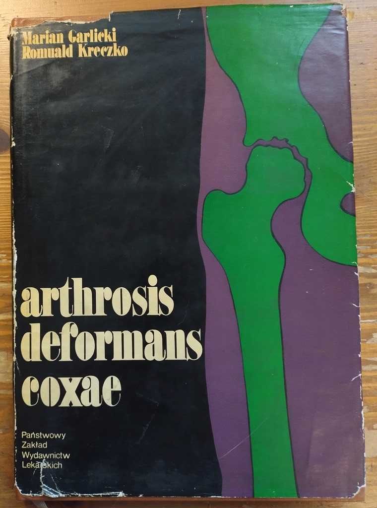 Ortopedia Garlicki Kreczko arthrosis deformans coxae