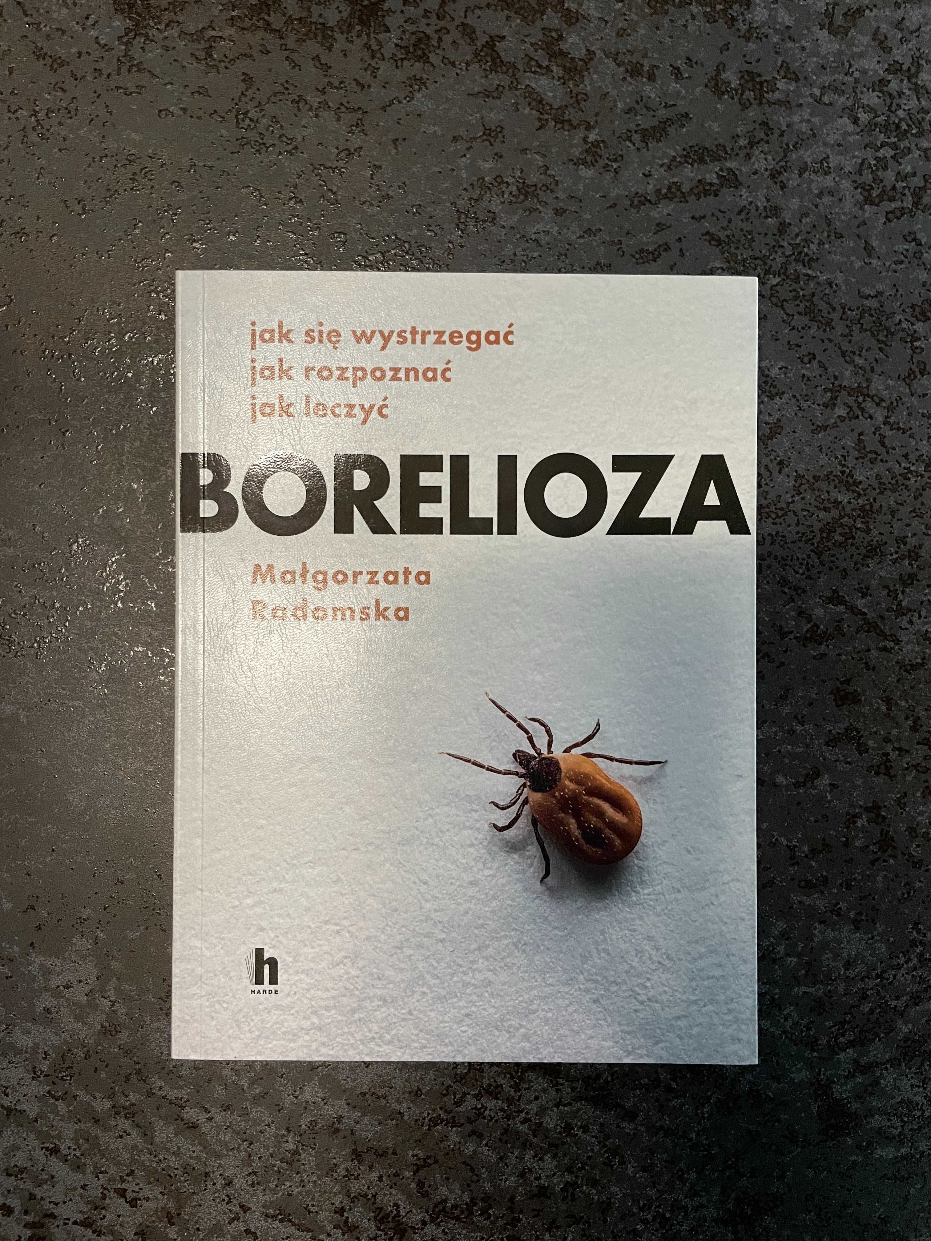 Borelioza - Małgorzata Radomska