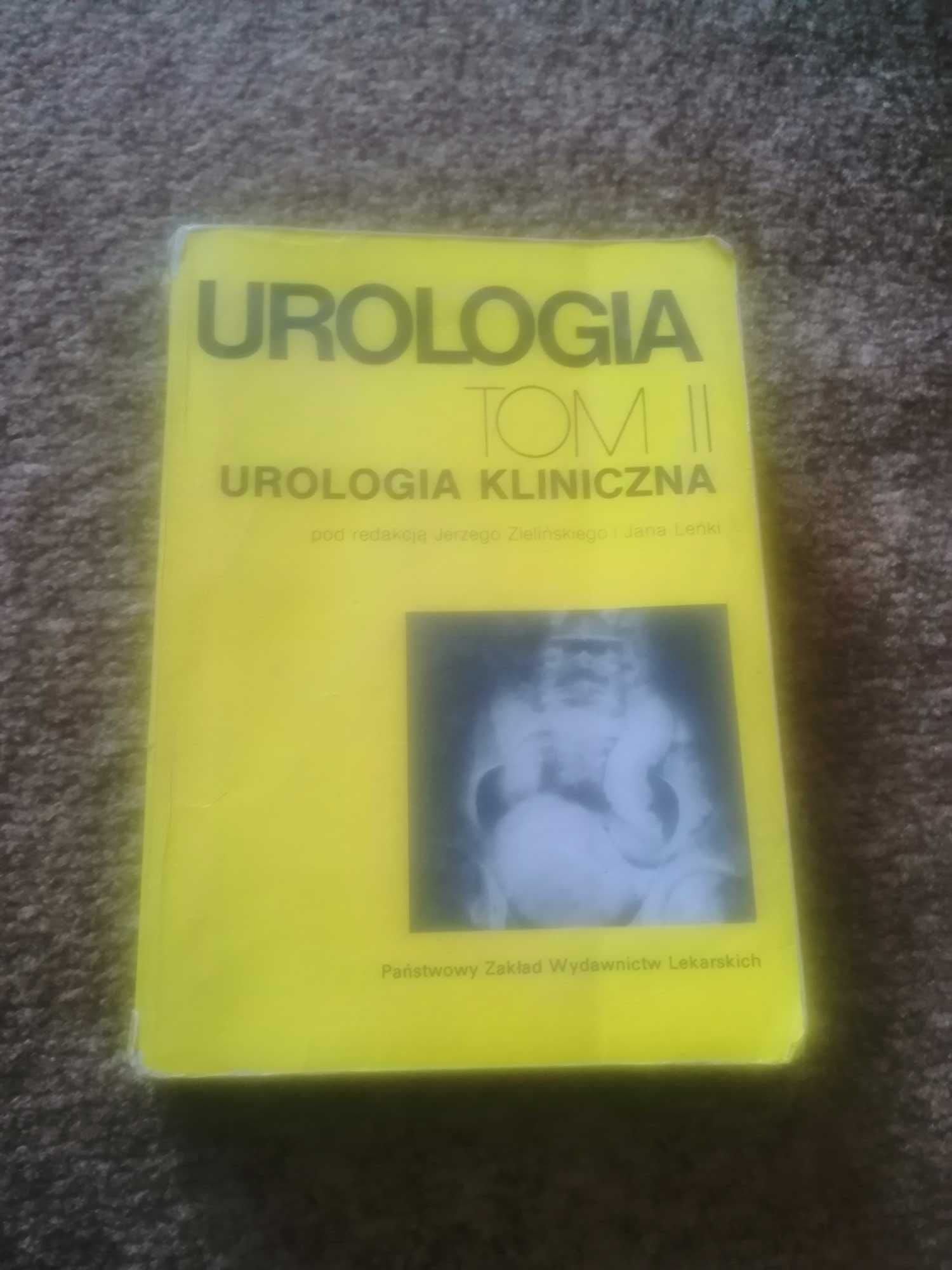 Urologia kliniczna tom II Jerzy Zieliński Jan Leńka