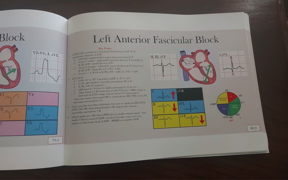 Livro de eletrocardiografia: Ultimate EKG Breakdown