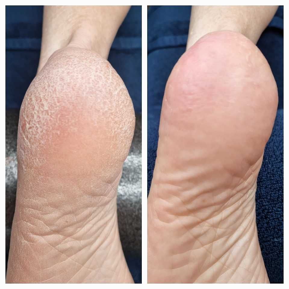 Serviço de estética de mãos, pés e  unhas ao domicílio.