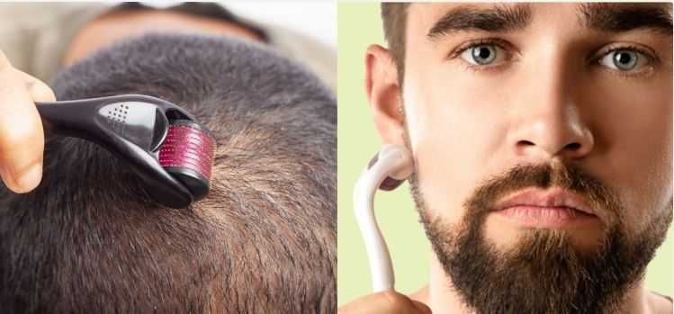 Microagulhamento capilar 0.5mm - fortalecimento de cabelo e barba