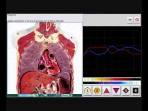 Máquina de Medicina Quântica Bioressonância