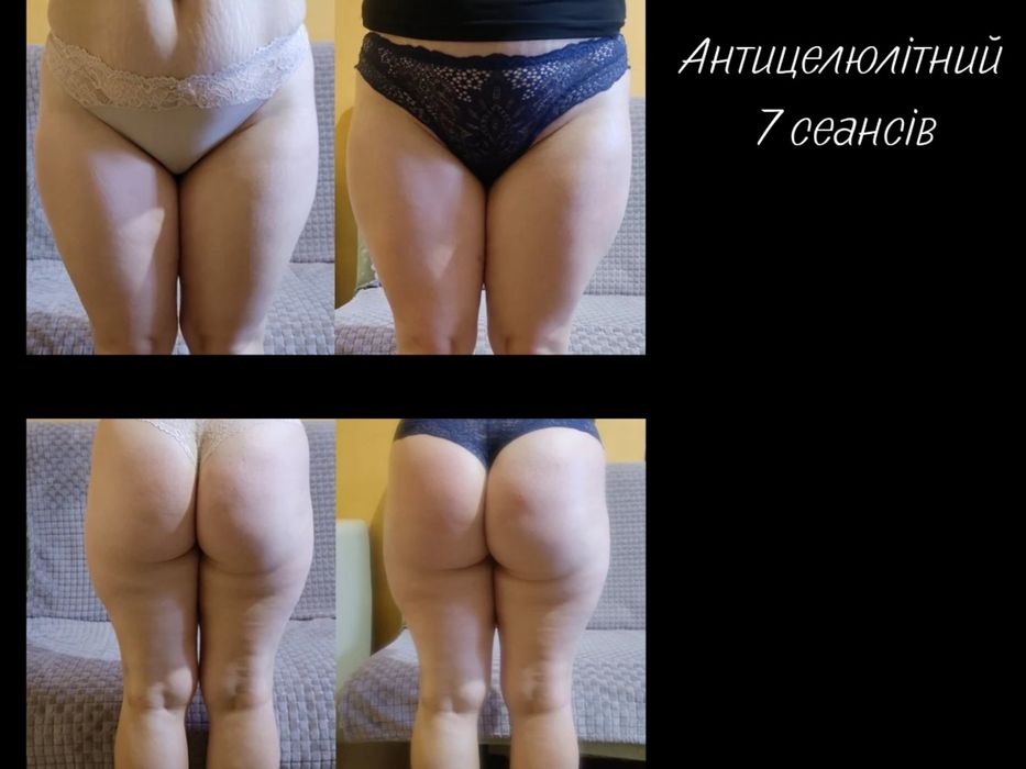 Масаж Київ. Оболонь. Мінська